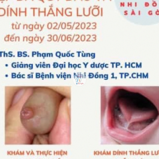 CÁC DỊCH VỤ CHUYÊN KHOA : CẮT DÍNH THẮNG LƯỠI, NONG HẸP- DÍNH BAO QUI ĐẦU- ĐỐT CHỒI RỐN...